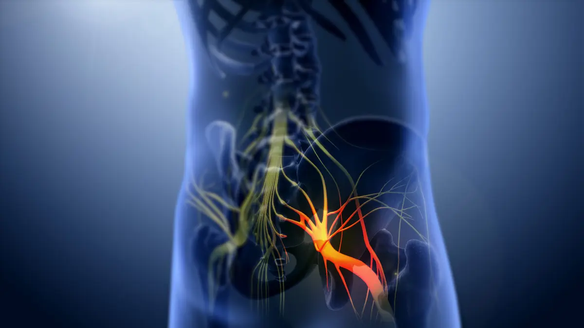 Essential Oils for Sciatica: Pain Evidence, Limits and Warning Signs