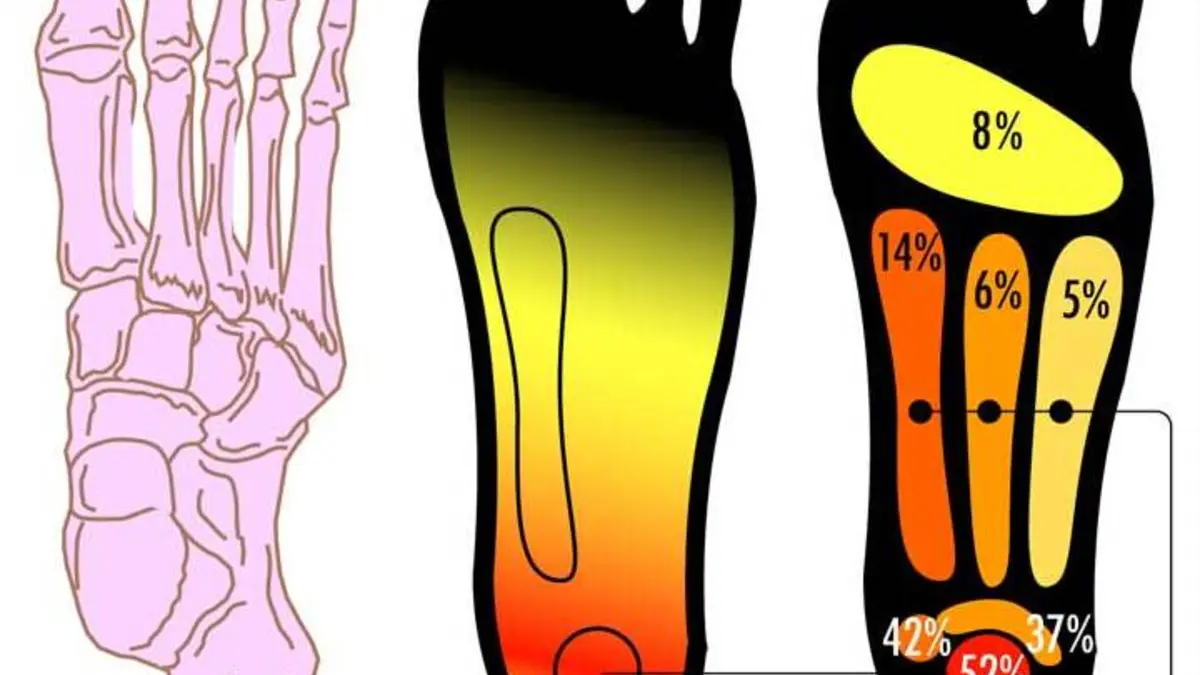 Essential Oils for Plantar Fasciitis: Evidence and Safer Care