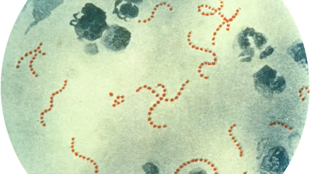 Microscope photograph showing chains of Streptococcus pyogenes bacteria in a stained specimen