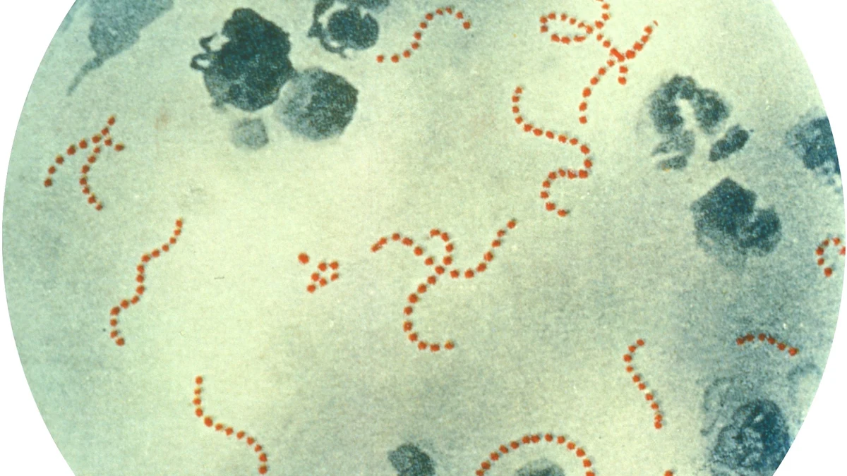 Microscope photograph showing chains of Streptococcus pyogenes bacteria in a stained specimen