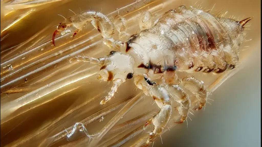 Close-up photograph of a human head louse; not an example of a treated scalp