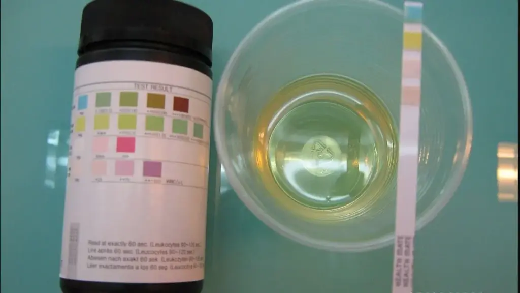 Urine dipstick and colour chart used in urine testing; essential oils do not treat a urinary infection