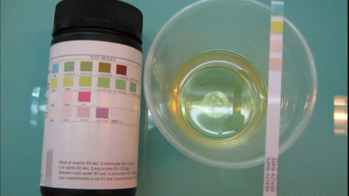 Essential Oils for UTI: Laboratory Evidence and Safer Care