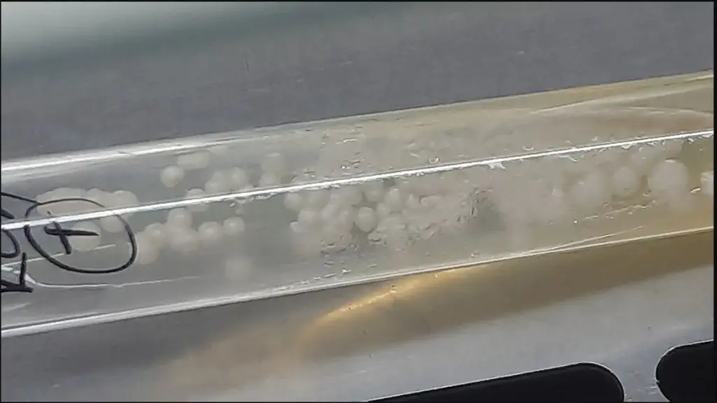 Candida albicans colonies grown in a laboratory; this is not a diagnostic image of vaginal thrush